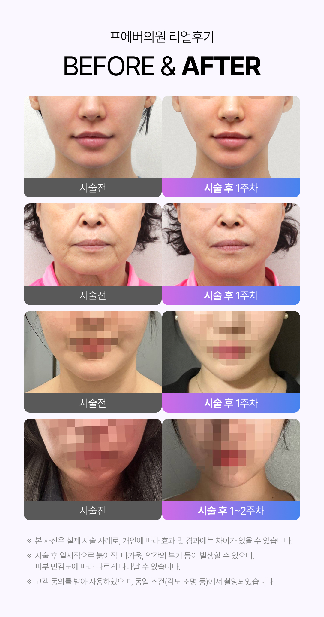 인모드