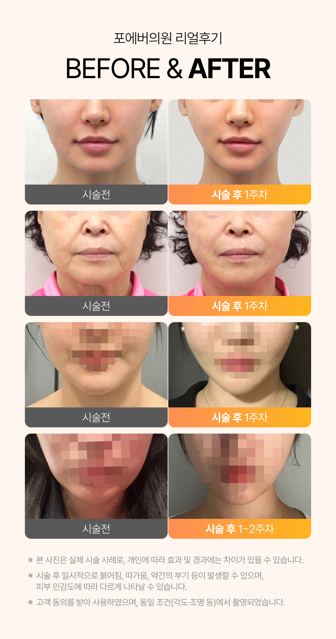 인모드
